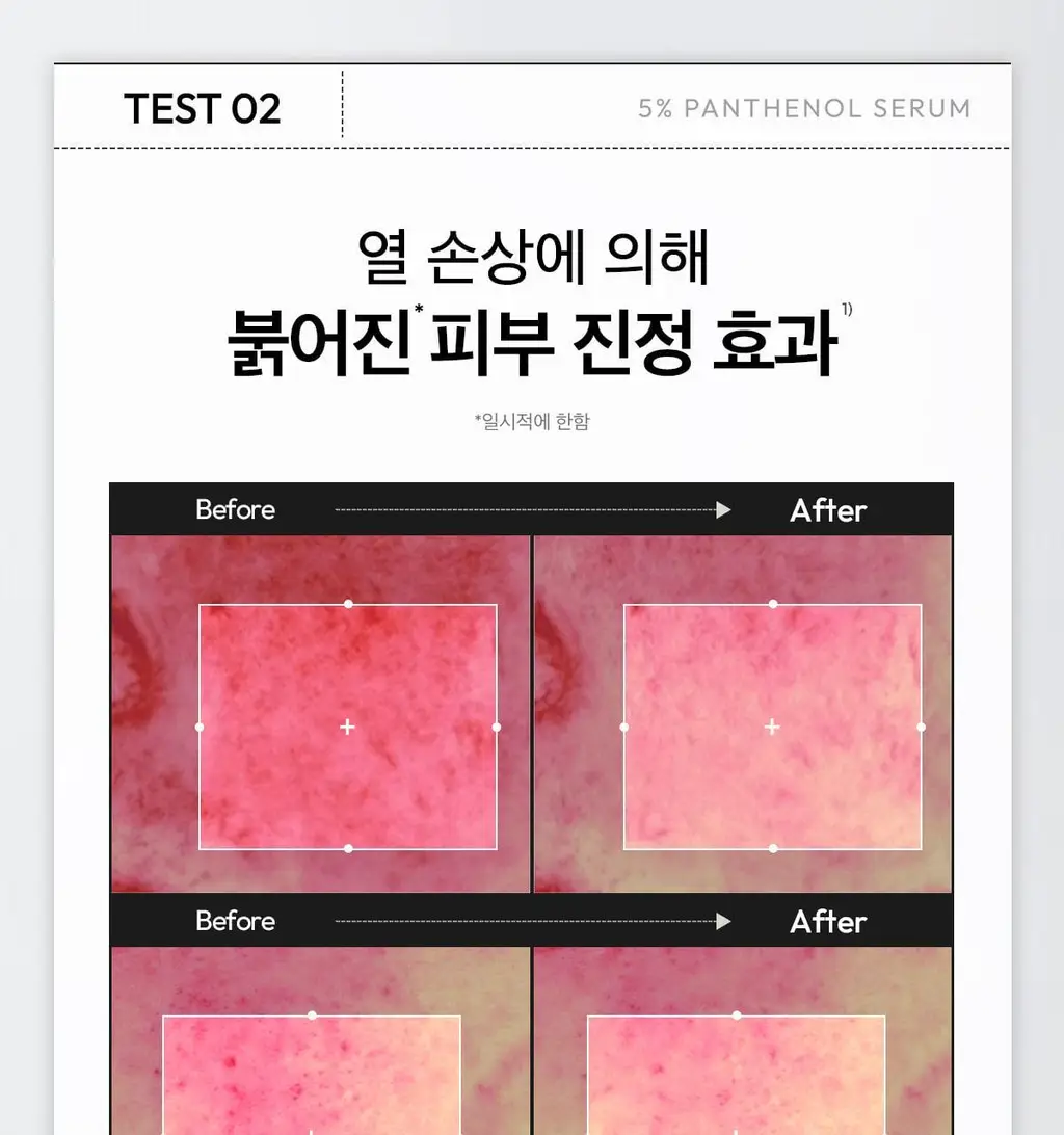 [급속진정 장벽개선] 레이어랩 니오좀 판테놀 5% 세럼 30ml 기획 (+1.5ml*5ea) 상세페이지 17